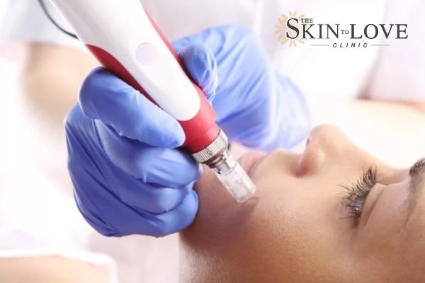 Non-surgical Skin Tightening