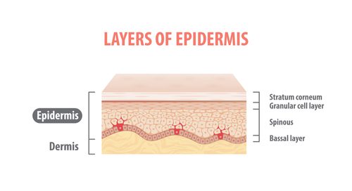 epidermis and melasma