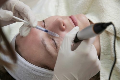 mesotherapy treatment