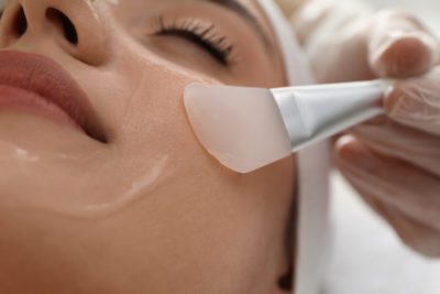 Best Chemical Peel for Hyperpigmentation