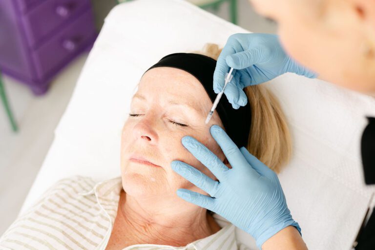 sculptra treatment st albans